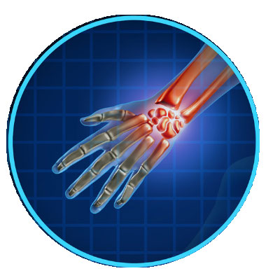 Arthritis-Treatment-1